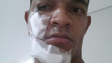 Atacante do Oeste traz a marca da violência na Série B