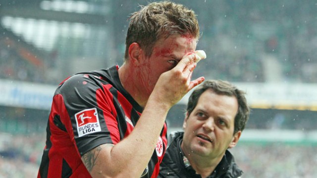 A Bundesliga passou a aderir ao MMA. Ou quase isso
