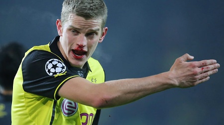 Acredite, a loja oficial ajudou o Dortmund vencer o Napoli