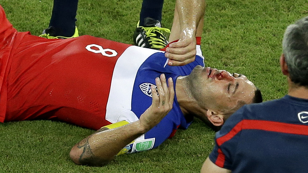 Dempsey depois de tomar um chute involunt&aacute;rio de Boye no nariz (AP Photo/Hassan Ammar)