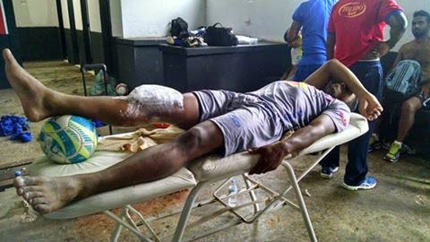 O clube publicou a foto do goleiro machucado para comprovar a les&atilde;o (Foto: Divulga&ccedil;&atilde;o)