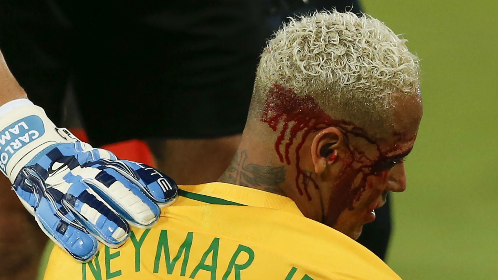 Boliviano nega inten&ccedil;&atilde;o em cotovelada, mas reclama: &ldquo;Neymar tem que respeitar seus rivais&rdquo;
