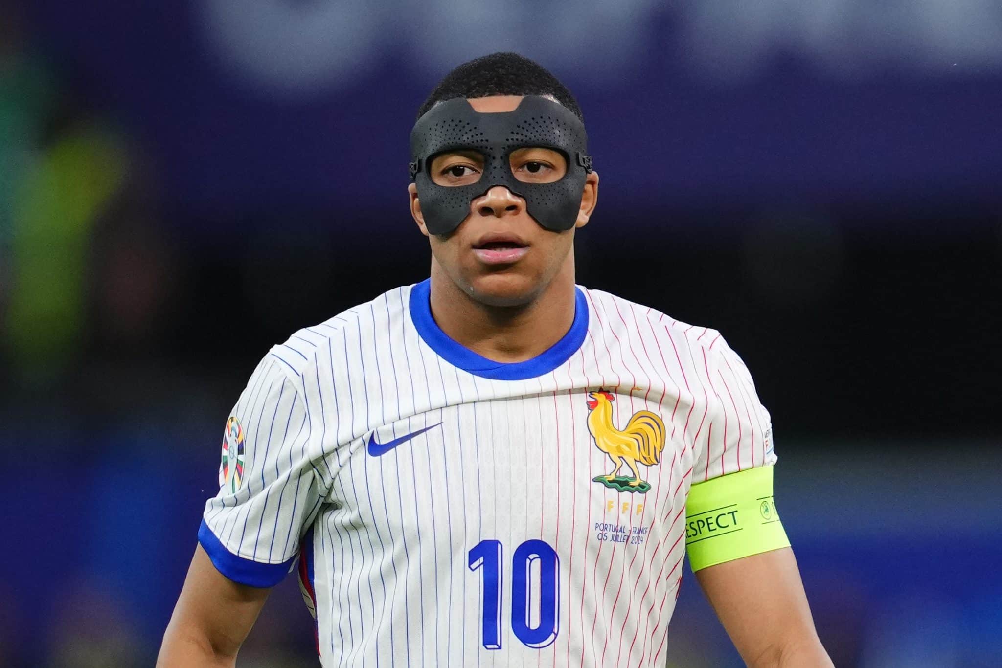 Fratura no nariz de Mbapp&eacute;