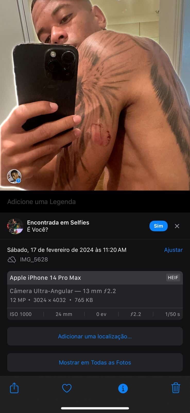 Foto de Caio Paulista, com mordida, que ele diz ser de Clara Monteiro 