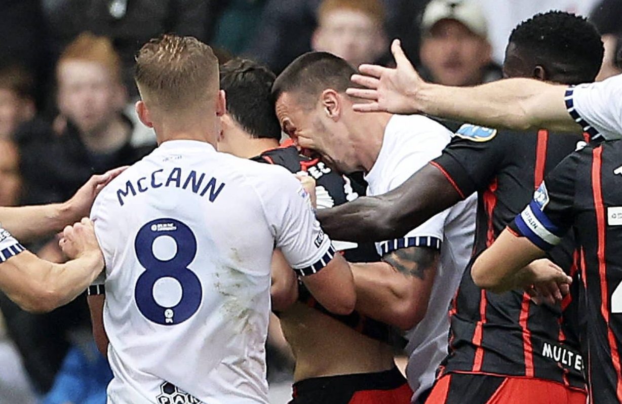 Na Inglaterra, atacante d&aacute; suposta mordida &lsquo;&agrave; la Su&aacute;rez&rsquo; e escapa de expuls&atilde;o