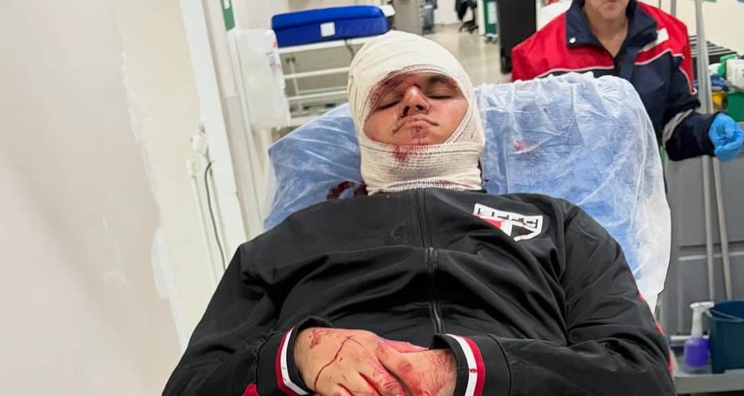 Torcedor denuncia omiss&atilde;o do S&atilde;o Paulo em socorro a feridos ap&oacute;s acidente no Morumbis