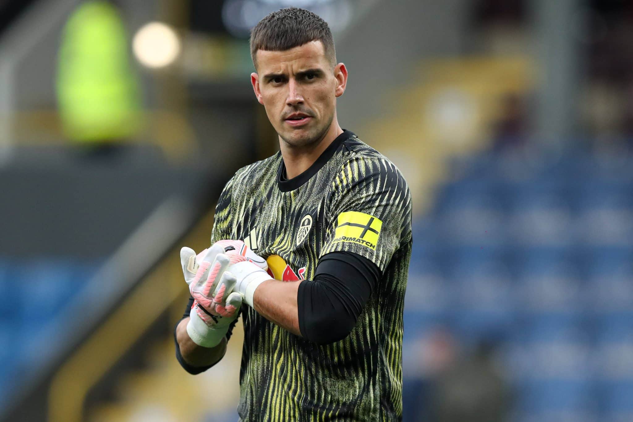 Karl Darlow, goleiro reserva do Leeds (Foto: Imago)